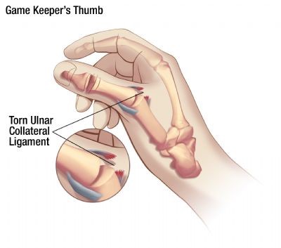 game keepers thumb